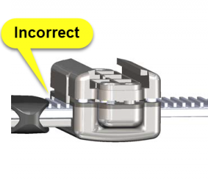 Incorrect buckle top and long strap alignment