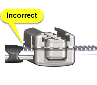 Incorrect buckle top and long strap alignment