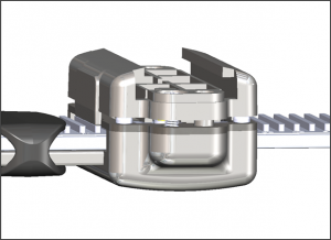 Improper Strap Alignment